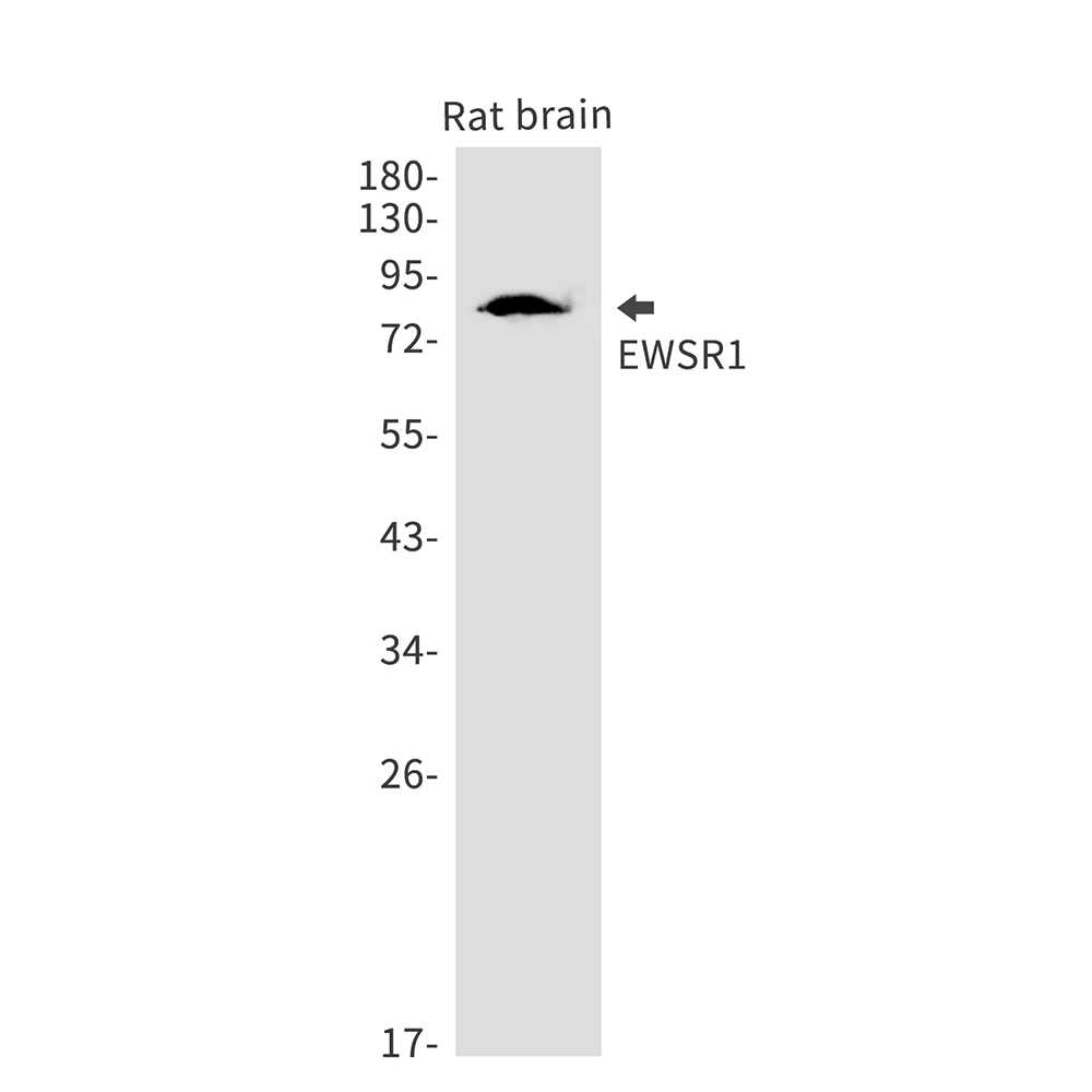 EWSR1 Rabbit mAb ABZ2263