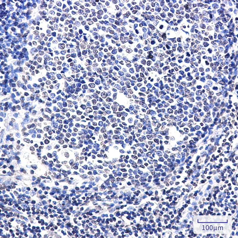 SATB1 Rabbit mAb ABZ2264