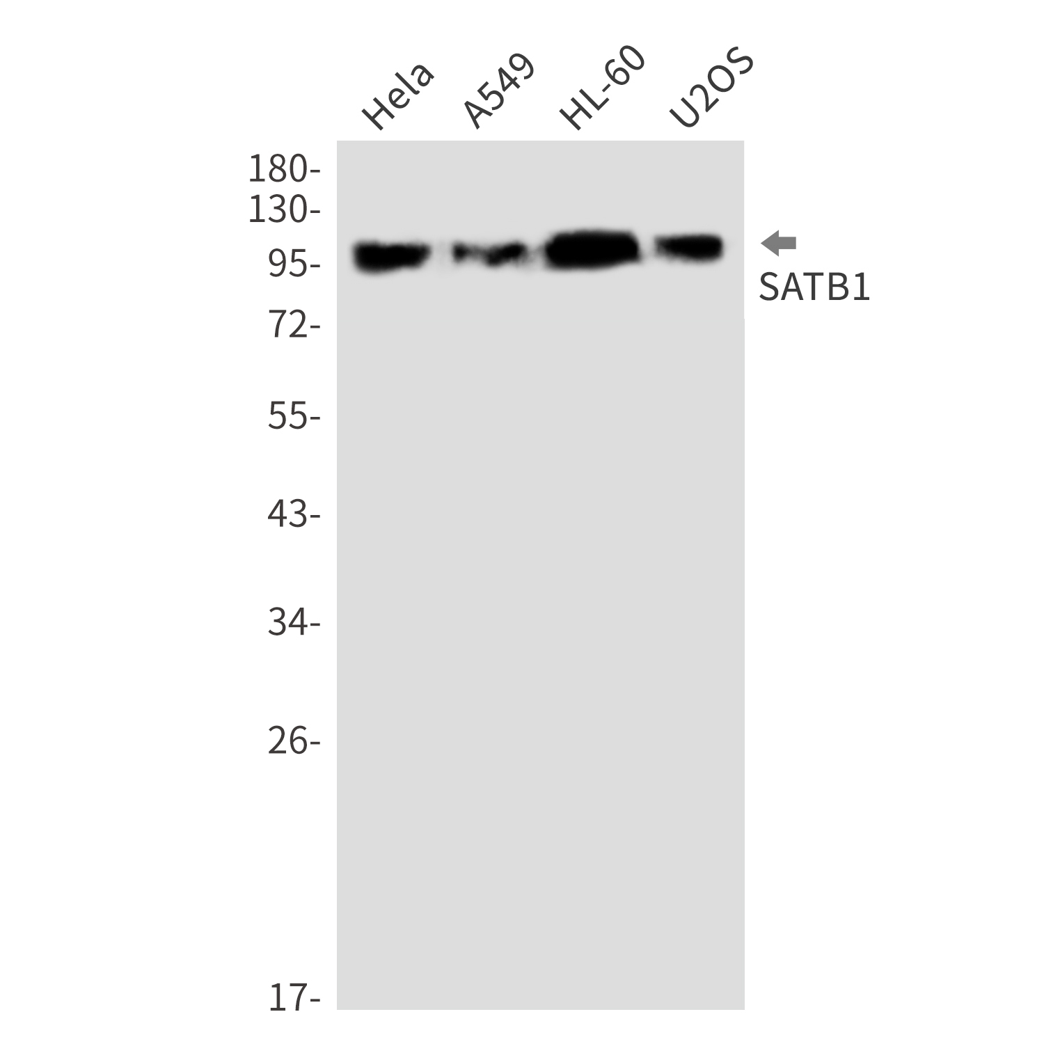 SATB1 Rabbit mAb ABZ2264
