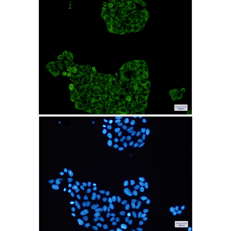 PFKP Rabbit mAb ABZ2265