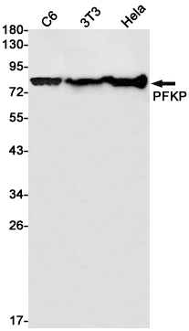 PFKP Rabbit mAb ABZ2265