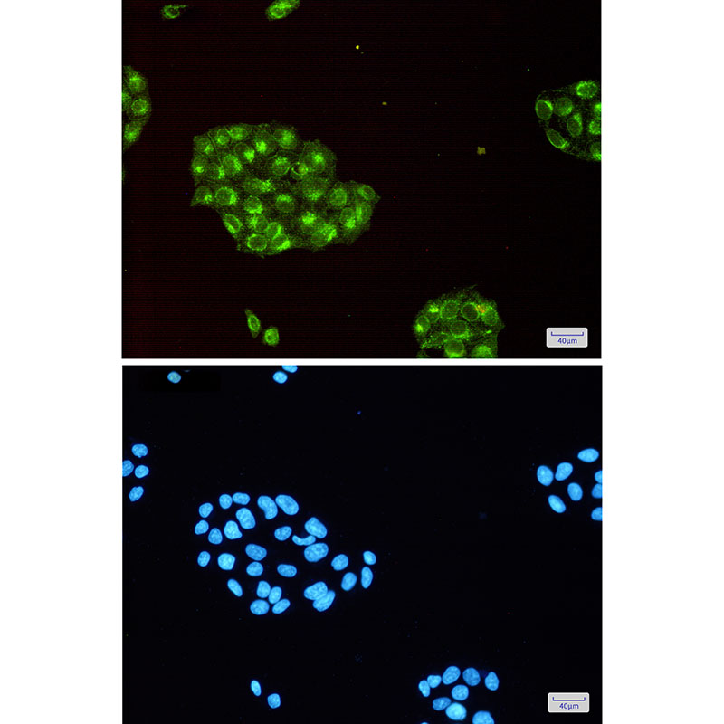 Fragilis Rabbit mAb ABZ2266