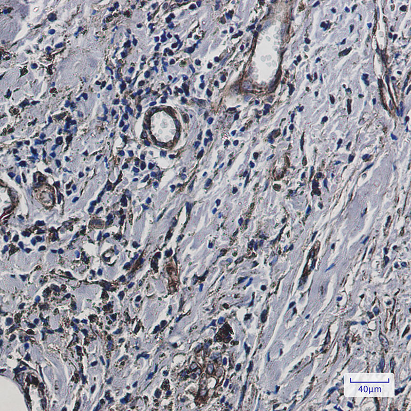 Fragilis Rabbit mAb ABZ2266