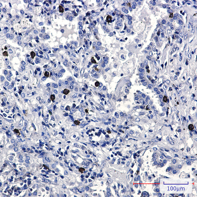 FLI1 Rabbit mAb ABZ2267