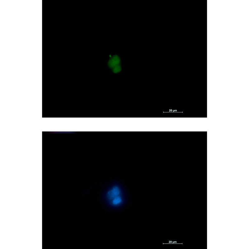 RUNX1/2/3 Rabbit mAb ABZ2268