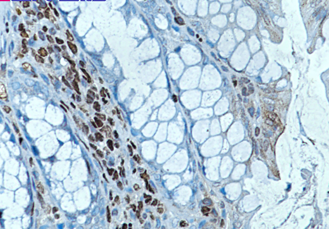 RUNX1/2/3 Rabbit mAb ABZ2268