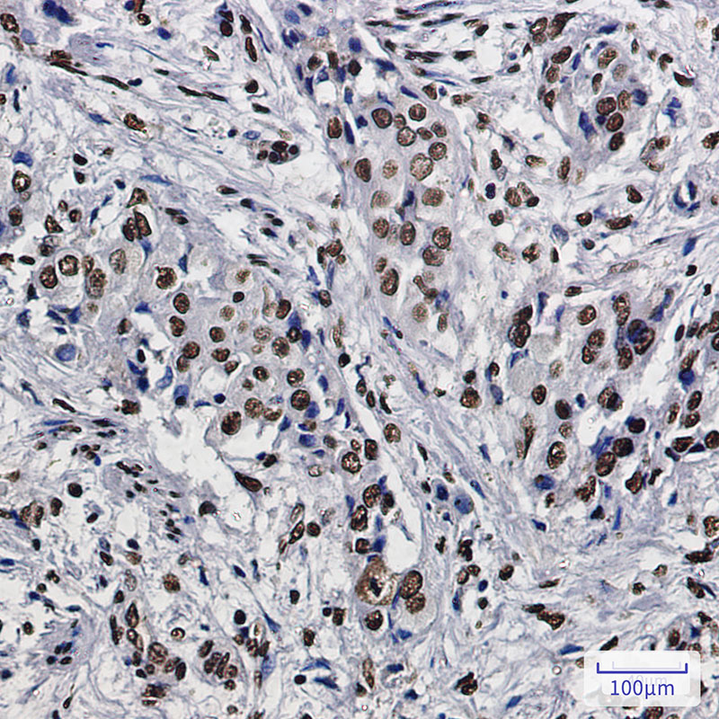 SET Rabbit mAb ABZ2270
