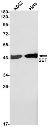 SET Rabbit mAb ABZ2270
