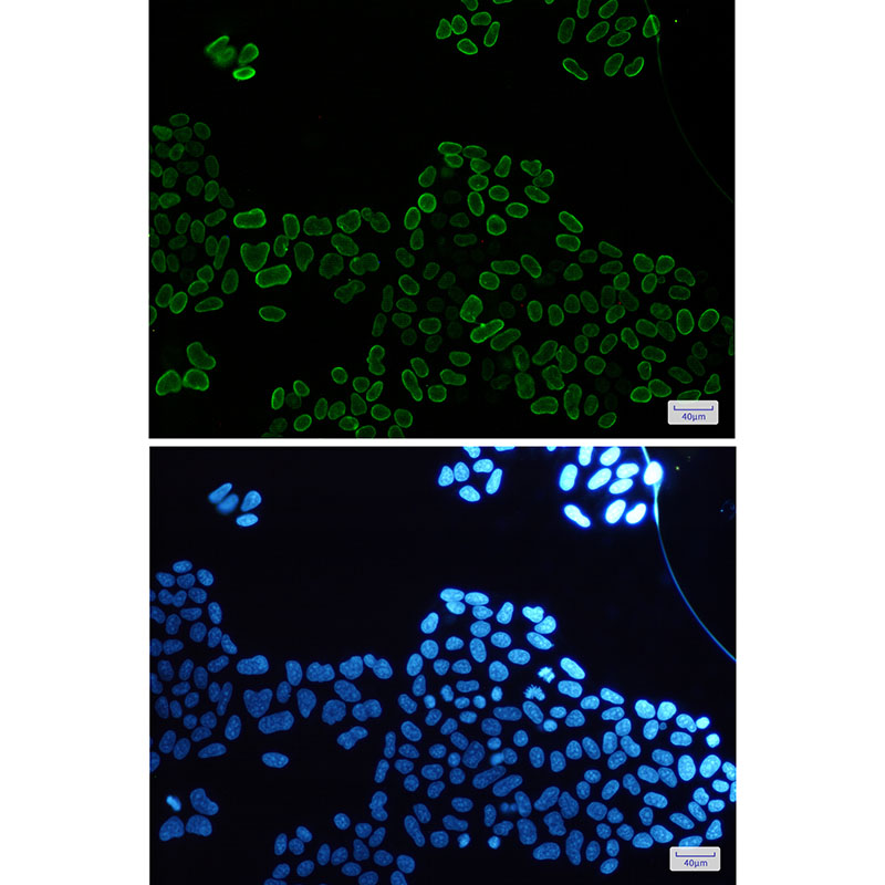 E2F1 Rabbit mAb ABZ2271