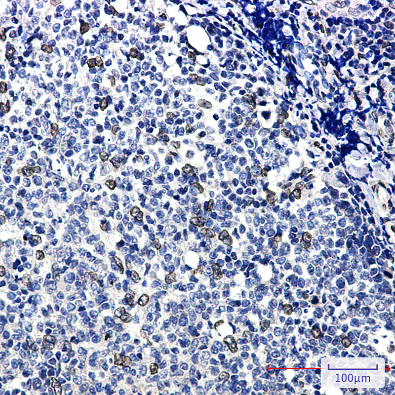 E2F1 Rabbit mAb ABZ2271