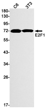 E2F1 Rabbit mAb ABZ2271