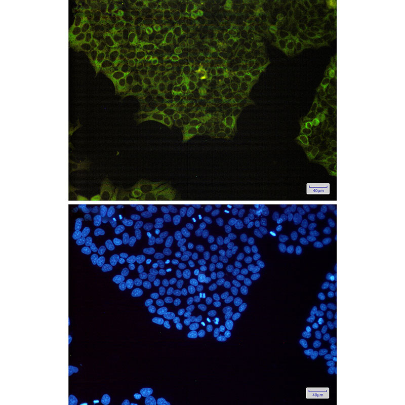 NF-KB p100 Rabbit mAb ABZ2272