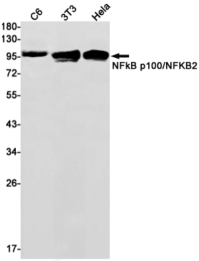 NF-KB p100 Rabbit mAb ABZ2272