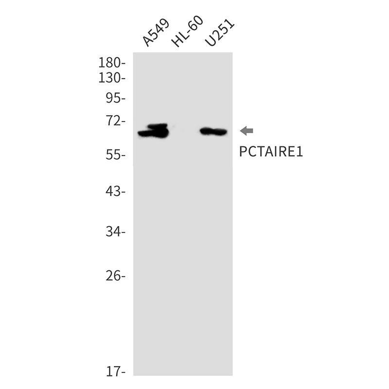 CDK16 Rabbit mAb ABZ2273
