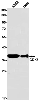 CDK6 Rabbit mAb ABZ2274
