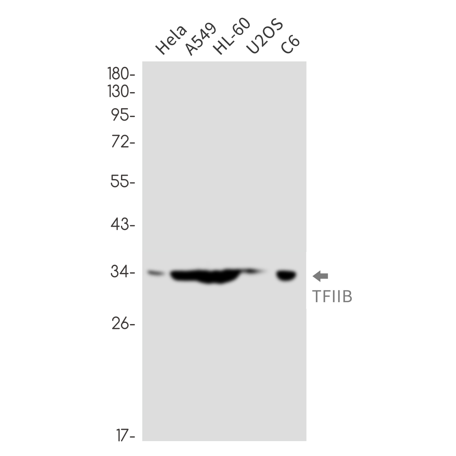 TFIIB Rabbit mAb ABZ2275