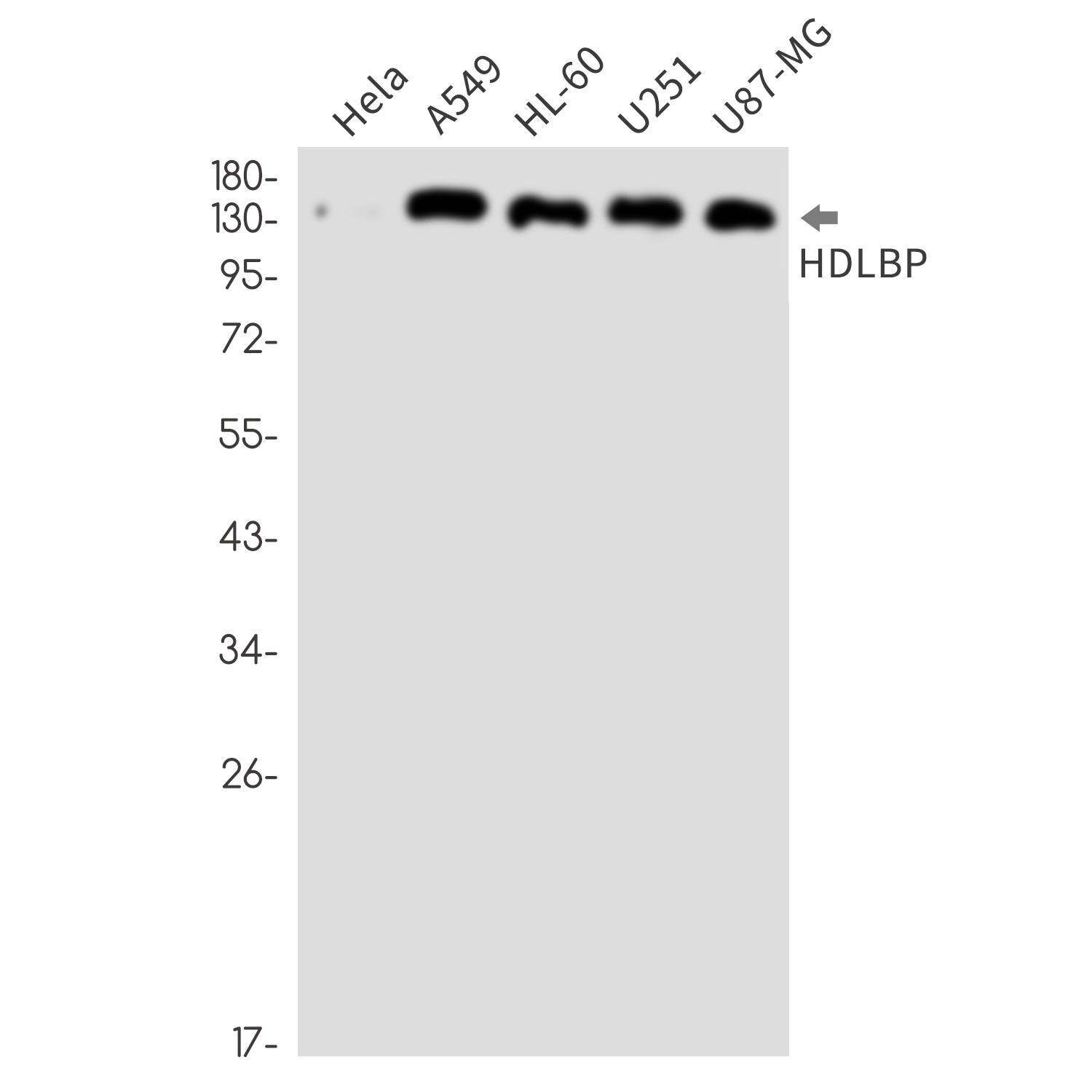 HDLBP Rabbit mAb ABZ2276