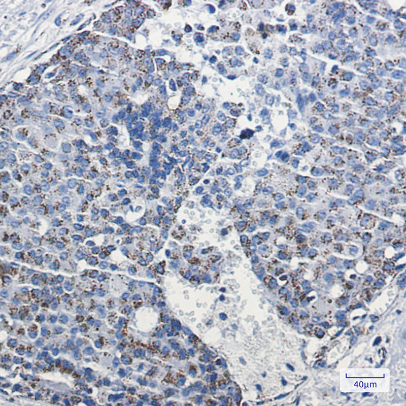 mtTFA Rabbit mAb ABZ2278