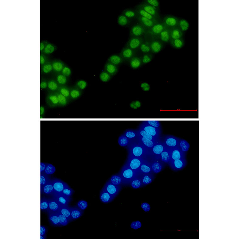 RBM3 Rabbit mAb ABZ2281