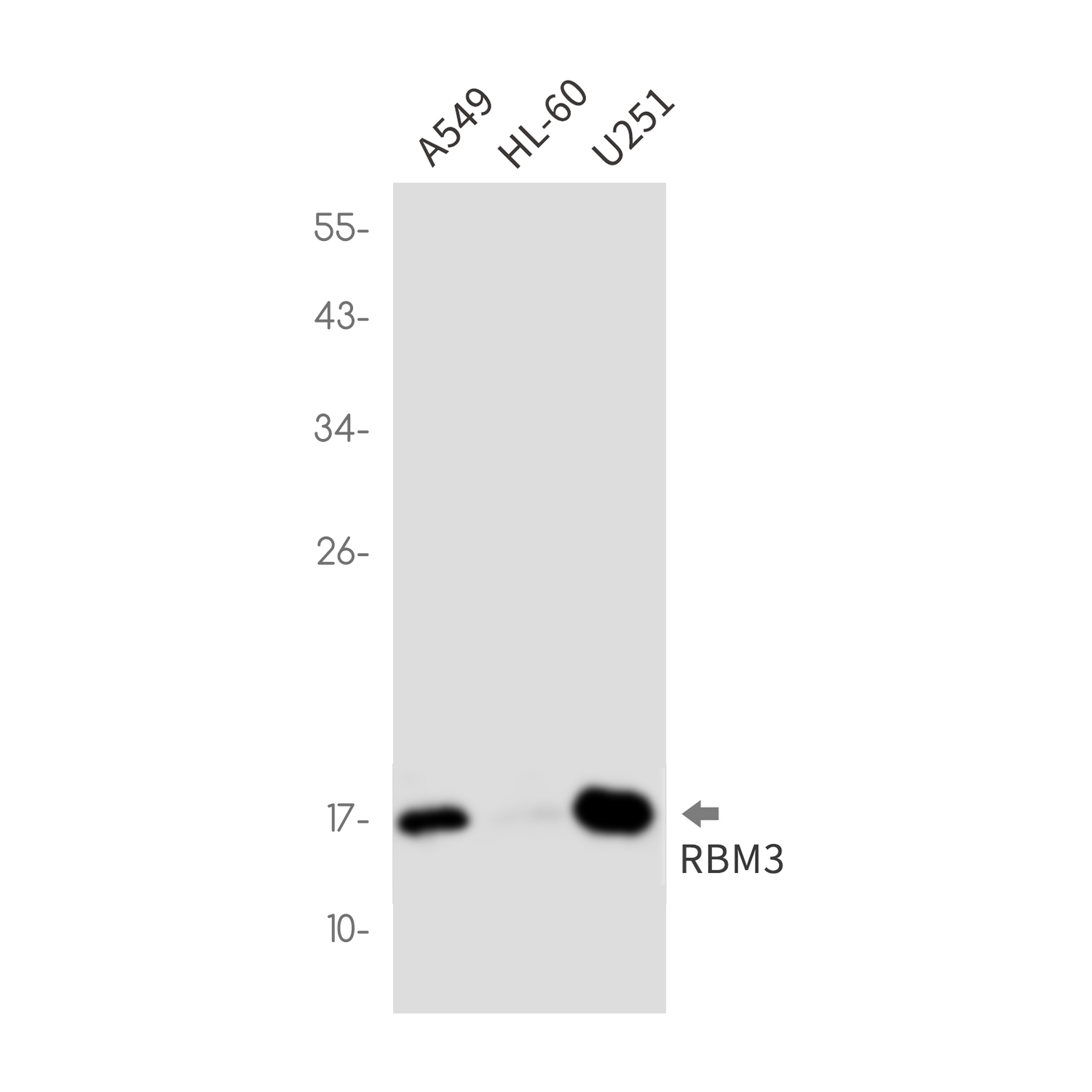 RBM3 Rabbit mAb ABZ2281