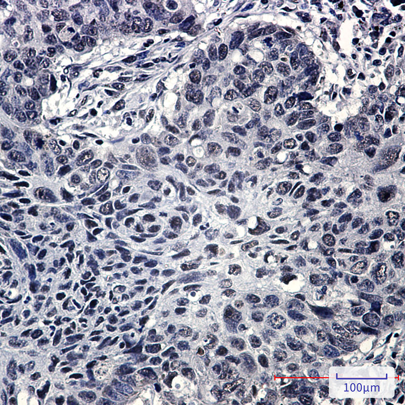 SRSF3 Rabbit mAb ABZ2285