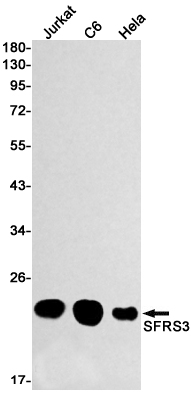 SRSF3 Rabbit mAb ABZ2285