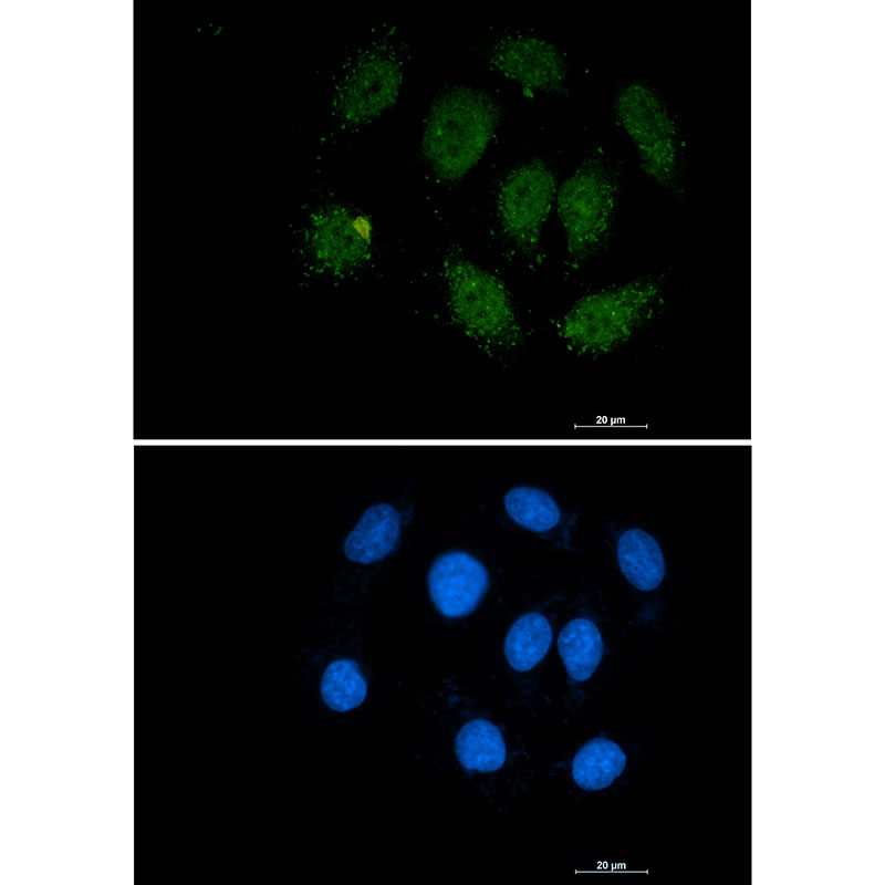 Smad3 Rabbit mAb ABZ2286