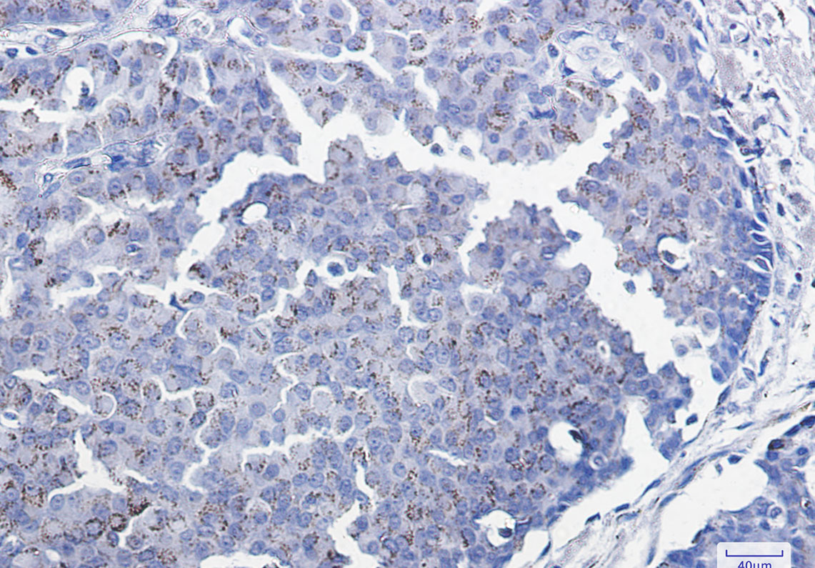 Smad3 Rabbit mAb ABZ2286