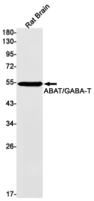 ABAT Rabbit mAb ABZ2288