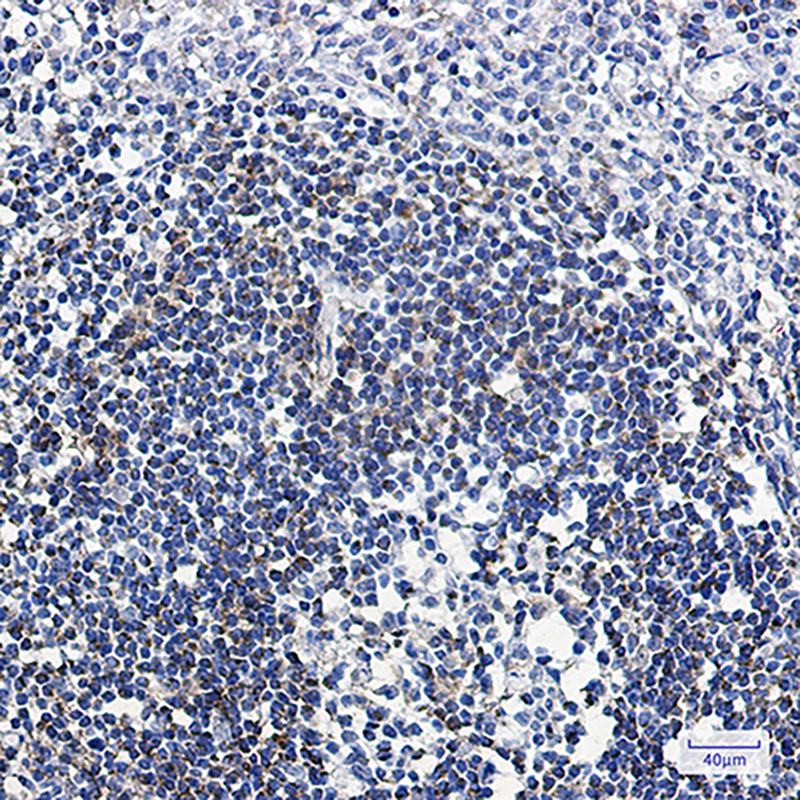 ABAT Rabbit mAb ABZ2289