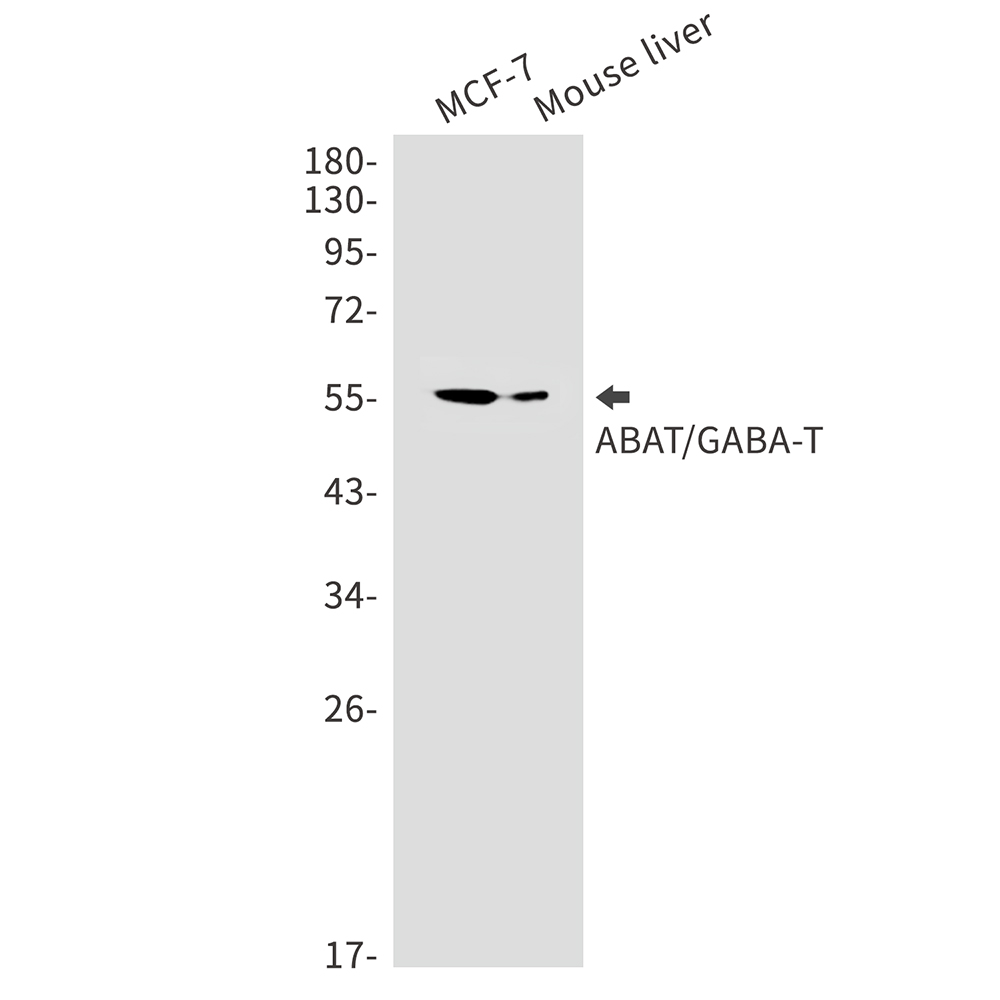 ABAT Rabbit mAb ABZ2289