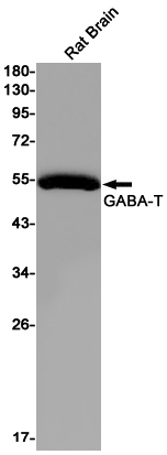 ABAT Rabbit mAb ABZ2289