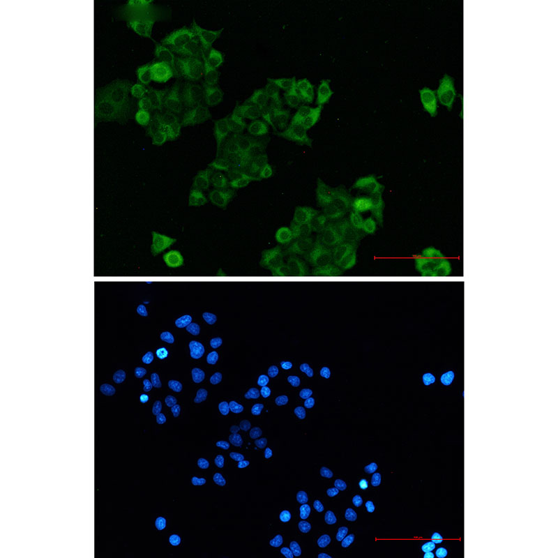 RAIDD Rabbit mAb ABZ2290