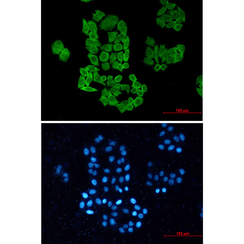 CCT2 Rabbit mAb ABZ2292