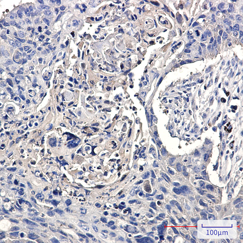 CCT2 Rabbit mAb ABZ2292