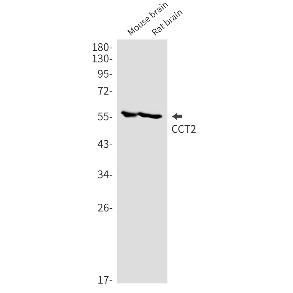 CCT2 Rabbit mAb ABZ2292