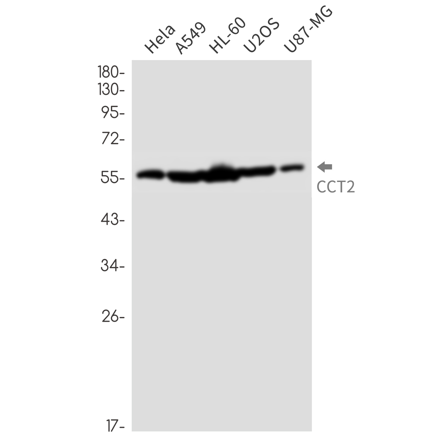 CCT2 Rabbit mAb ABZ2292