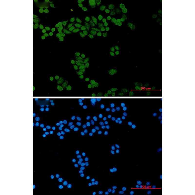 TFII I Rabbit mAb ABZ2293