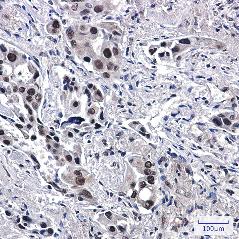 TFII I Rabbit mAb ABZ2293