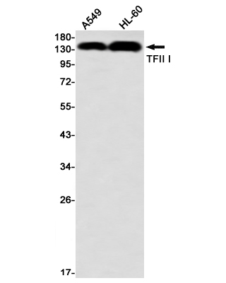 TFII I Rabbit mAb ABZ2293