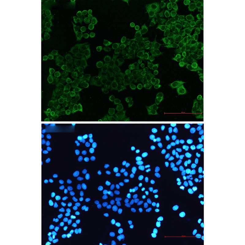 SIRP alpha Rabbit mAb ABZ2296
