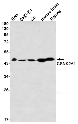 CSNK2A1 Rabbit mAb ABZ2299