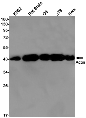ACTA1 Rabbit mAb ABZ2300