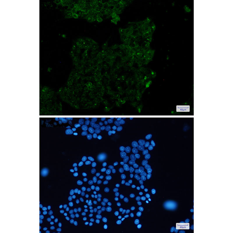 ACTA1 Rabbit mAb ABZ2301
