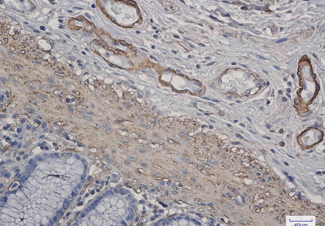 ACTA1 Rabbit mAb ABZ2301