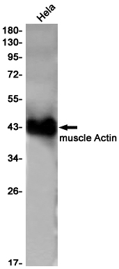 ACTA1 Rabbit mAb ABZ2301