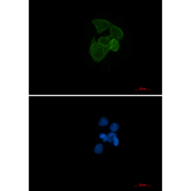 ACTA1 Rabbit mAb ABZ2302