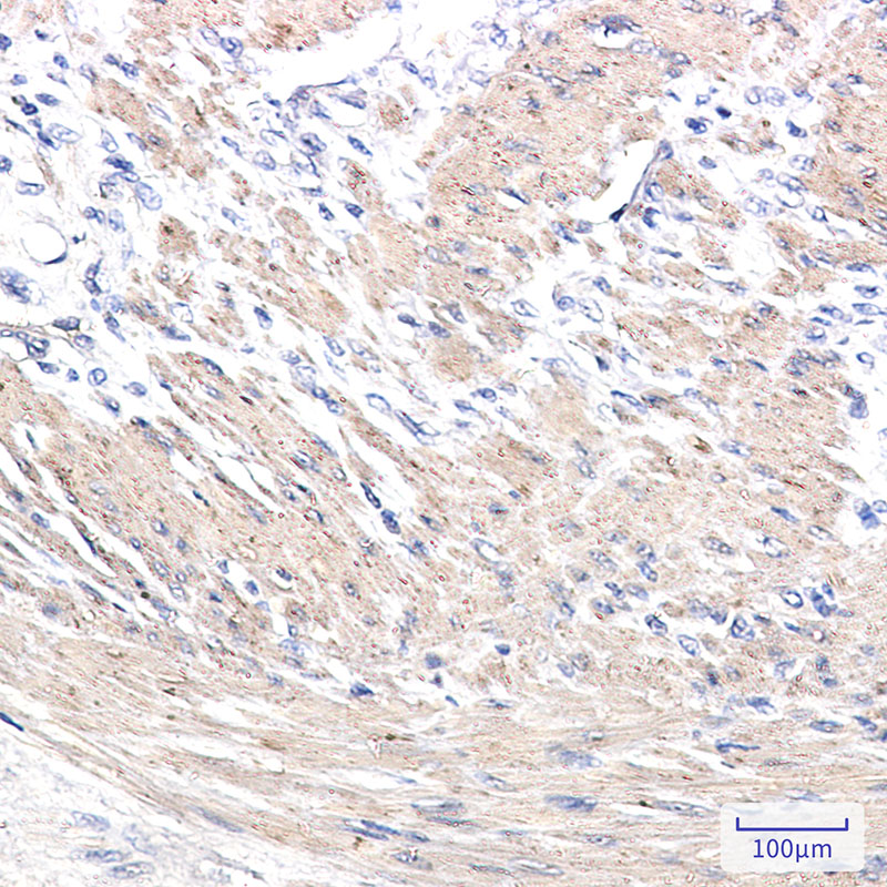 ACTA1 Rabbit mAb ABZ2302