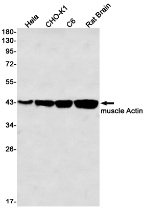 ACTA1 Rabbit mAb ABZ2302