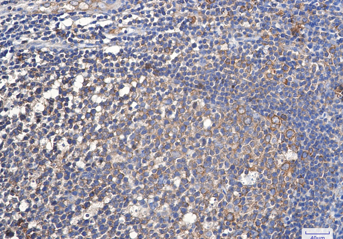 eEF1A1/EF-Tu Rabbit mAb ABZ2303